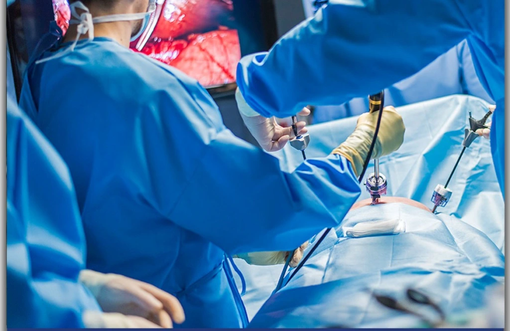 Laparoskopi ameliyatı